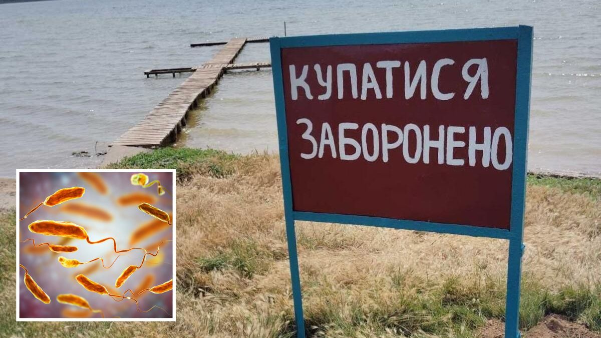 У Дніпропетровській області на дитячому пляжі виявили холерний вібріон: що робити жителям регіону, аби вберегти здоров’я