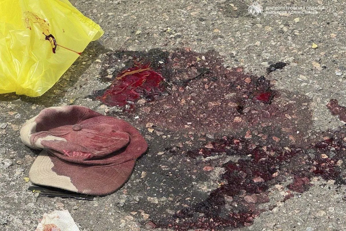У Дніпрі зросла кількість постраждалих внаслідок атаки рф, 4 людини – “важкі” 7