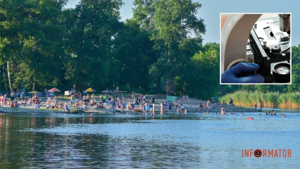 Інфекційна ситуація в Дніпропетровській області: у водоймах виявили неепідемічний холерний вібріон