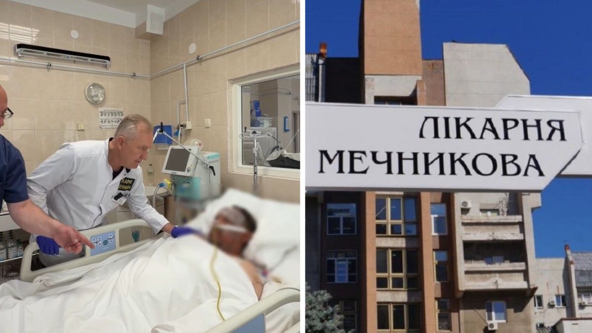 Уламки в животі та обгоріле обличчя: у Дніпрі рятують 45-річного пораненого воїна