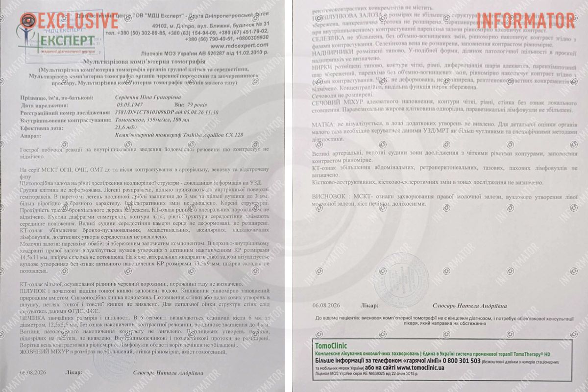 Результати Комп'ютерної томографії допом 3
