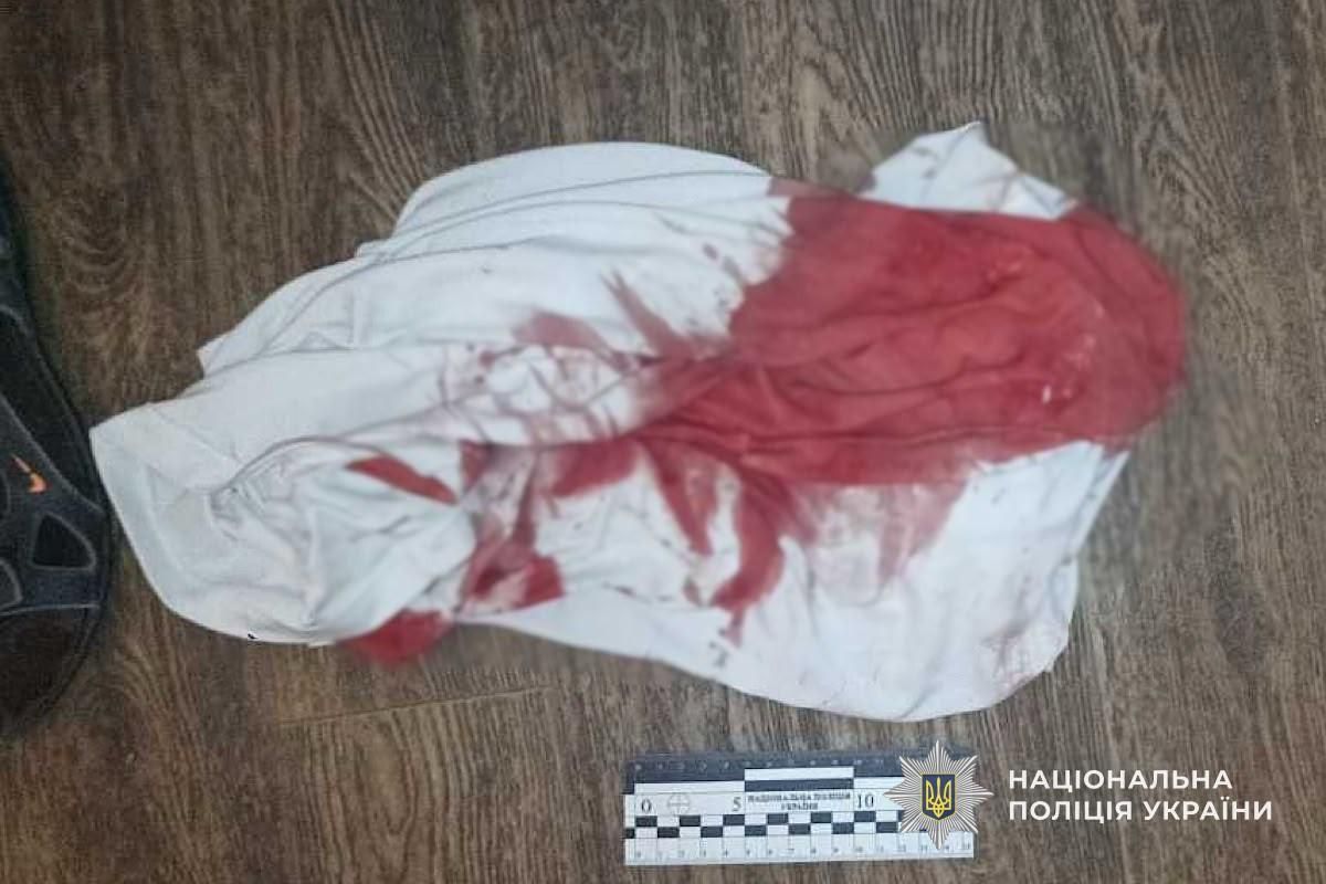 Нападника вже затримали правоохоронці Нападника вже затримали правоохоронці