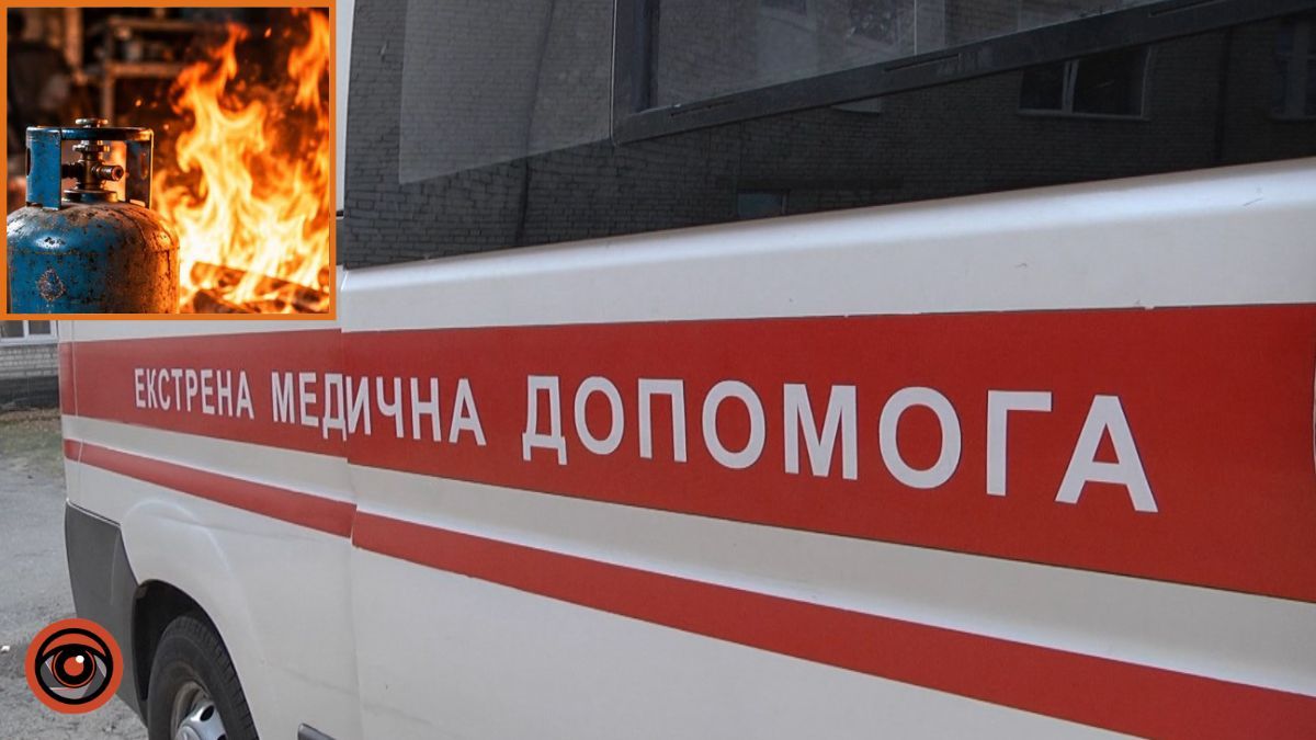 Вогонь охопив речі: у Нікополі в гаражі пролунав вибух, чоловіка з опіками доставили до лікарні