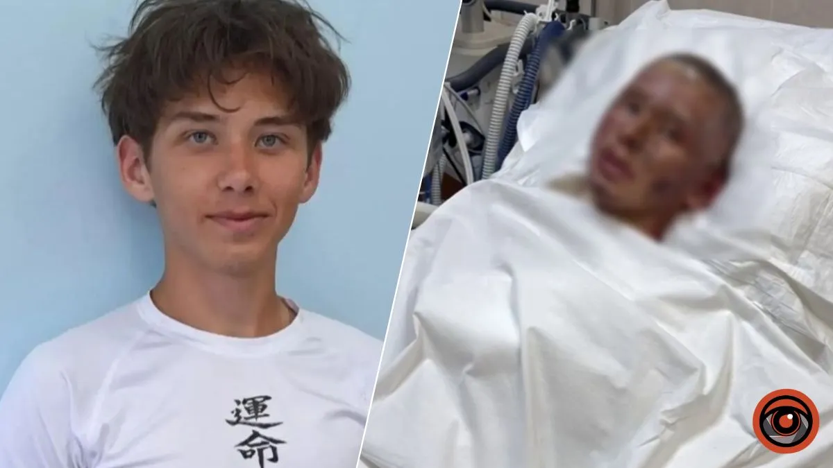 «Бачу – вже повна калюжа крові»: у Дніпрі прийшов до тями 15-річний хлопець, який вижив під час удару по «Новій пошті»