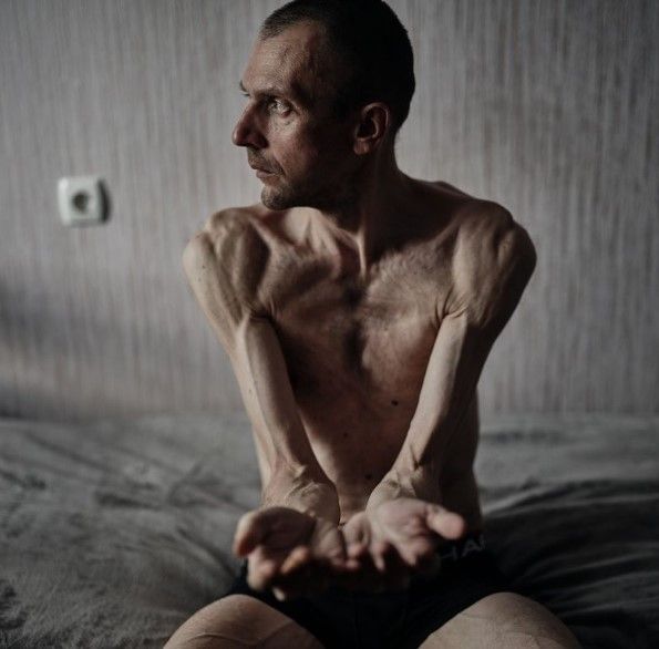 Украинские защитники вернулись из плена измученными. Фото - супруги Либеровы. Украинские защитники вернулись из плена измученными. Фото - супруги Либеровы.