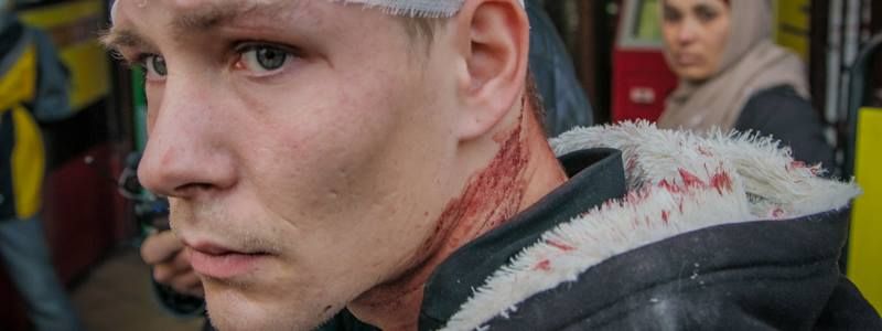 На Бессарабке цыганка ударила прохожего кирпичом по голове