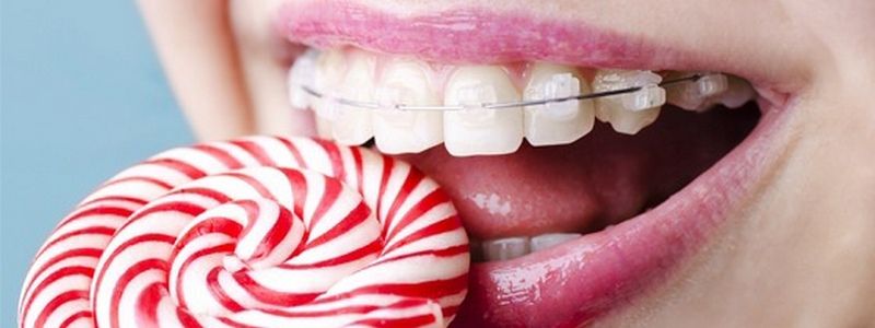 В каком возрасте нужно вести ребенка к ортодонту и как исправить последствия во взрослом возрасте