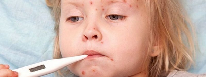 Где в Киеве самый высокий риск заразиться корью