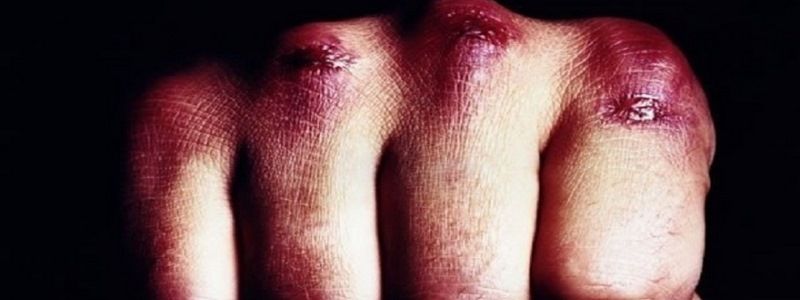 В Киеве мужчина пришел в гости на пьянку и убил хозяйку