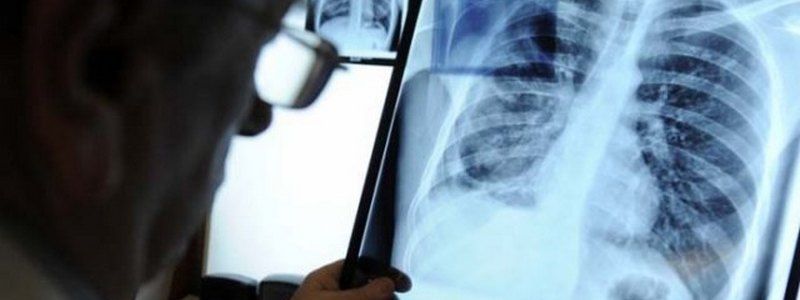 Как в Киеве провериться на туберкулез онлайн