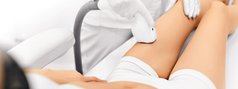 Где в Киеве сделать лазерную эпиляцию и что нужно знать о процедуре