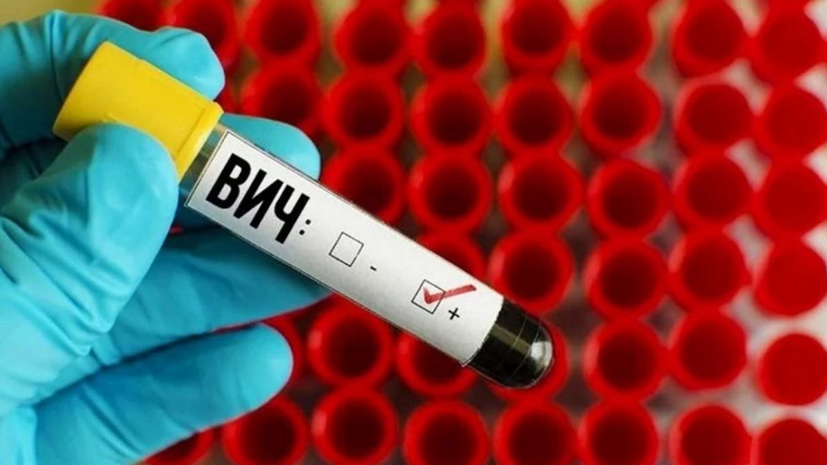 Сколько людей в Украине живут с ВИЧ-инфекцией