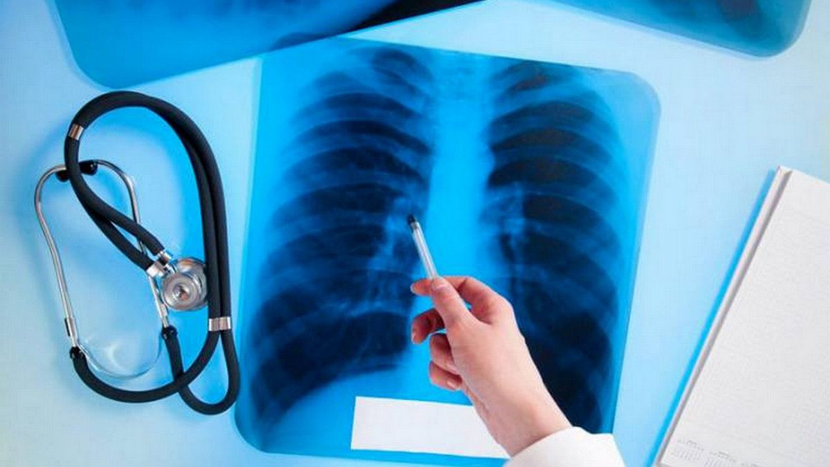 Где в Киеве бесплатно проверить легкие в декабре: адреса