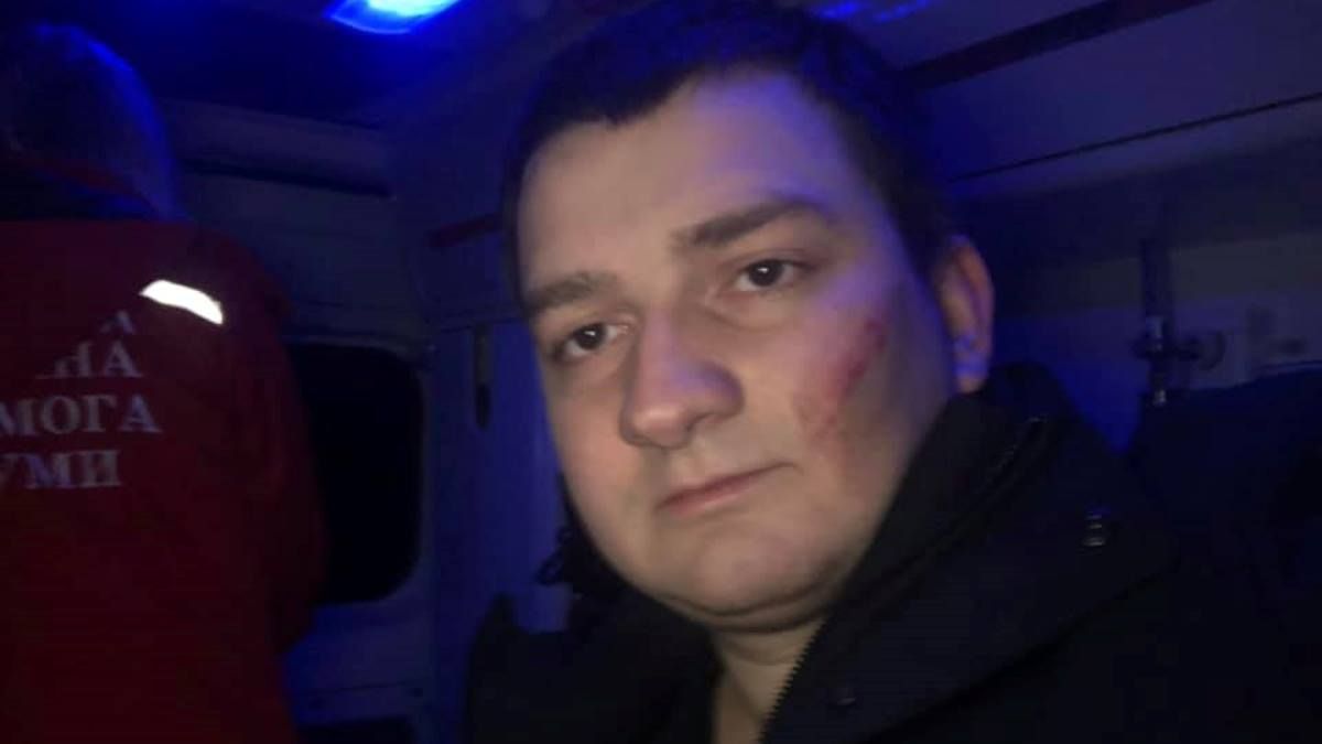 В Сумах избили депутата из "Слуги народа"