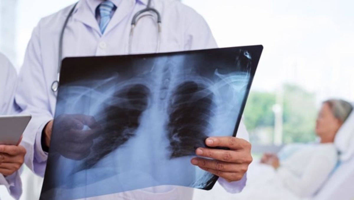 Сколько человек в Киеве сейчас болеют пневмонией: у пациентов взяли анализ на коронавирус