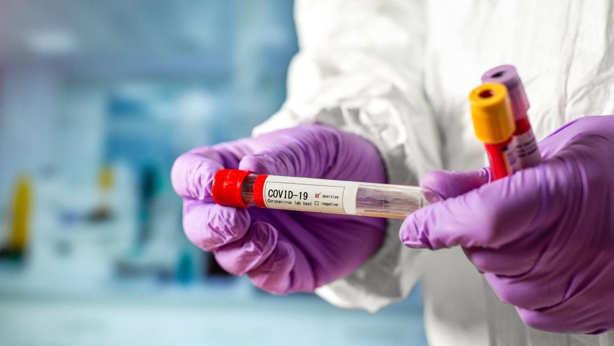 В Украине снова антирекорд по COVID-19: за сутки 2328 новых случаев