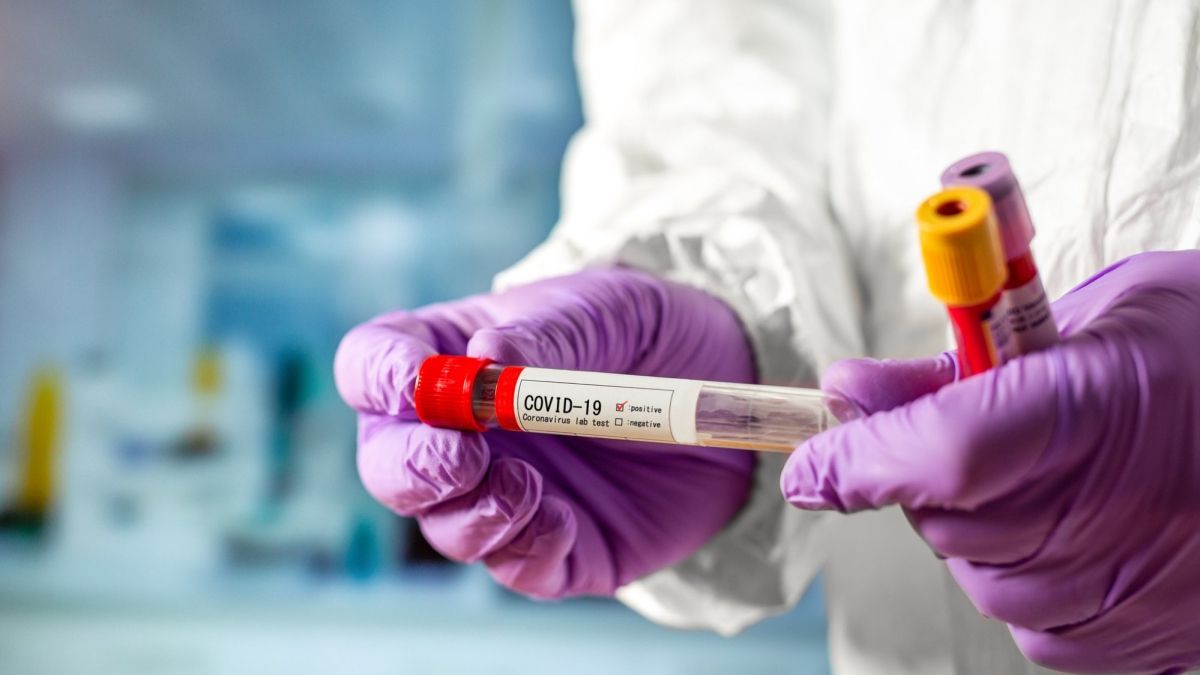 В Украине снова антирекорд: почти 9 тысяч случаев коронавируса за сутки