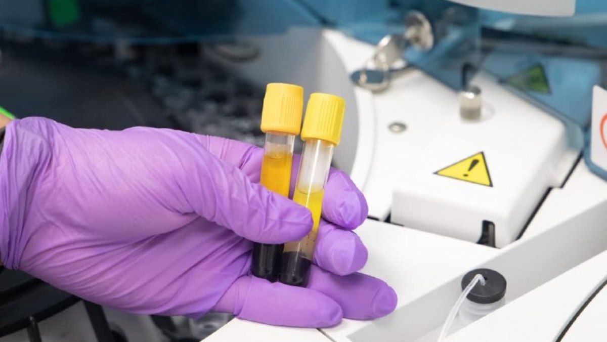 В Украине за сутки всего 4 тысячи новых случаев коронавируса: статистика по регионам