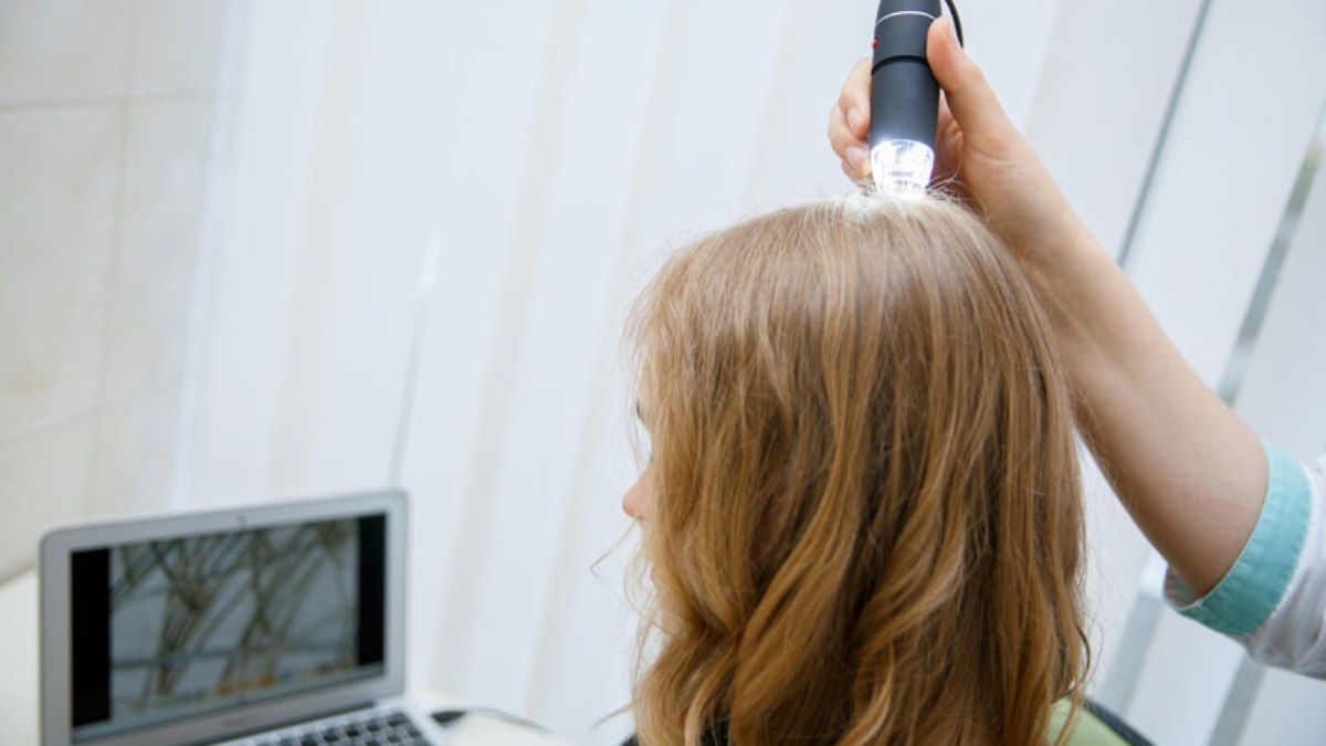 Трихология: пять часто задаваемых вопросов