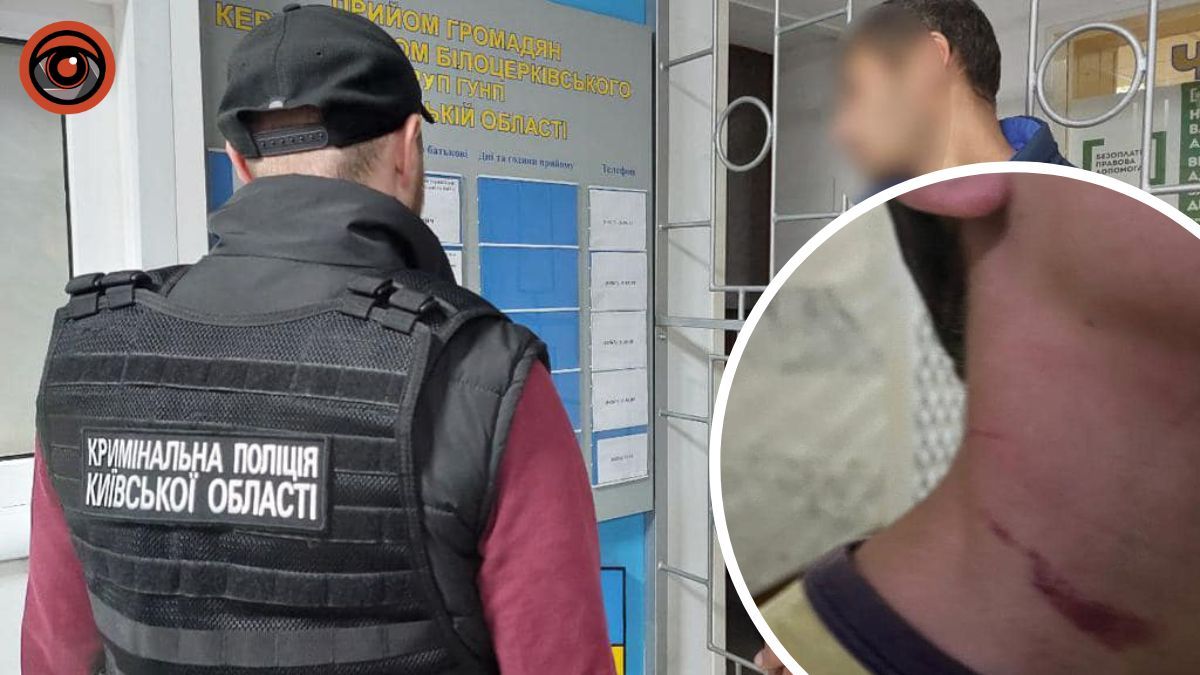 Душив дитину електрокабелем: на Київщині 39-річний чоловік намагався вбити свого пасинка