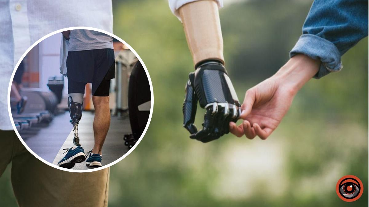 Куди в Україні звертатись з питаннями протезування кінцівок