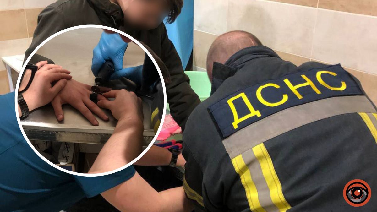 На Київщині у дитини на пальці застрягло металеве кільце від ліхтарика