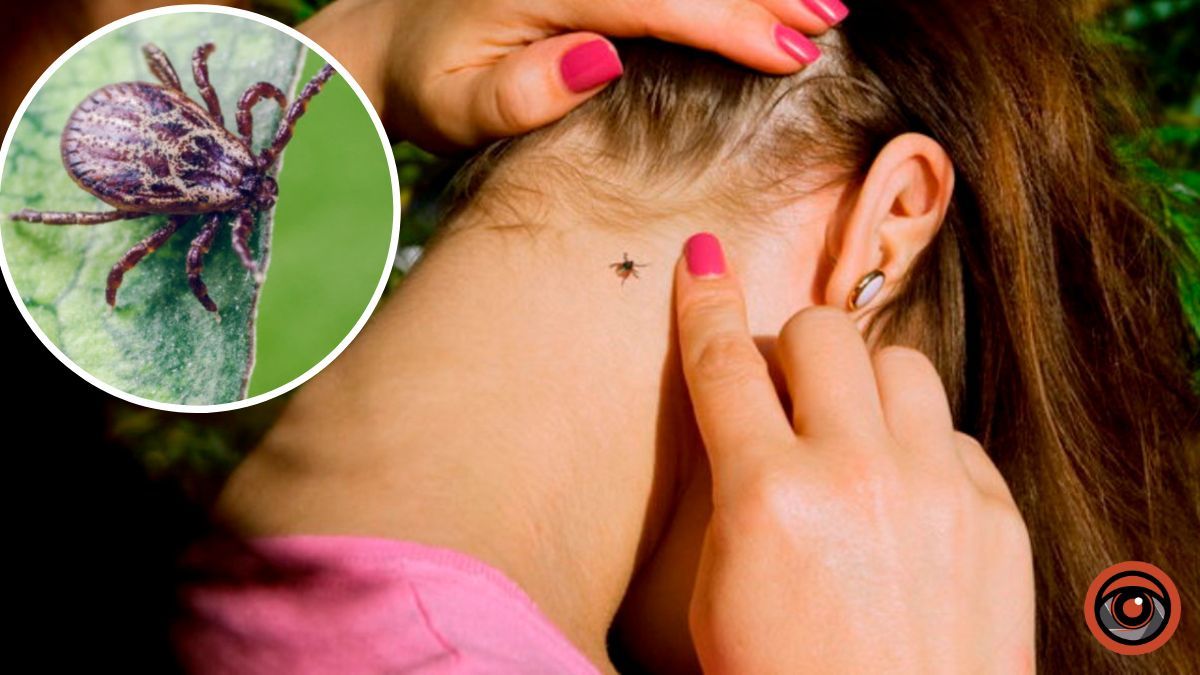 Яку небезпеку несуть укуси кліщів у Києві
