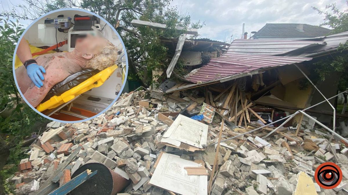 На Київщині у приватному будинку стався вибух: постраждав власник