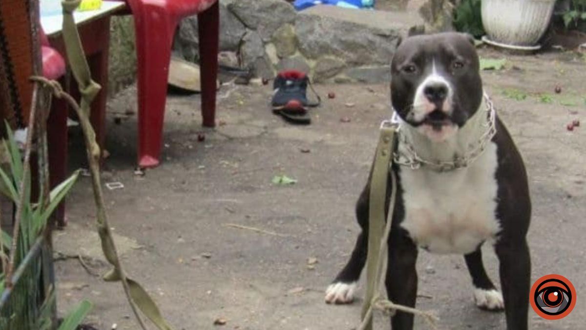 На Київщині собака напав та покусав дитину: у хлопчика перелом кісток