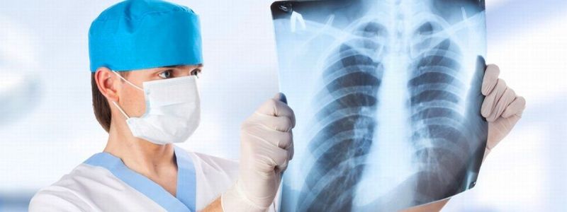 В Киеве работает передвижной флюорограф: где пройти обследование