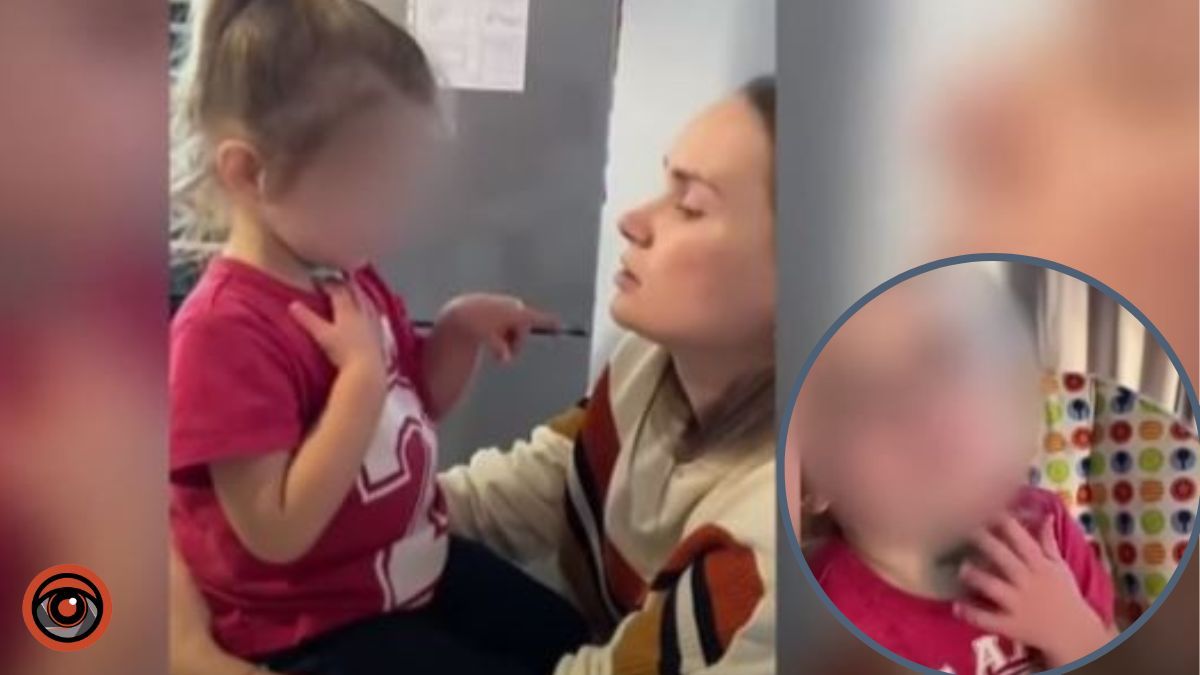 У Києві дитина повернулась з садочка в синцях та подряпинах: в побитті дівчинки підозрюють виховательку