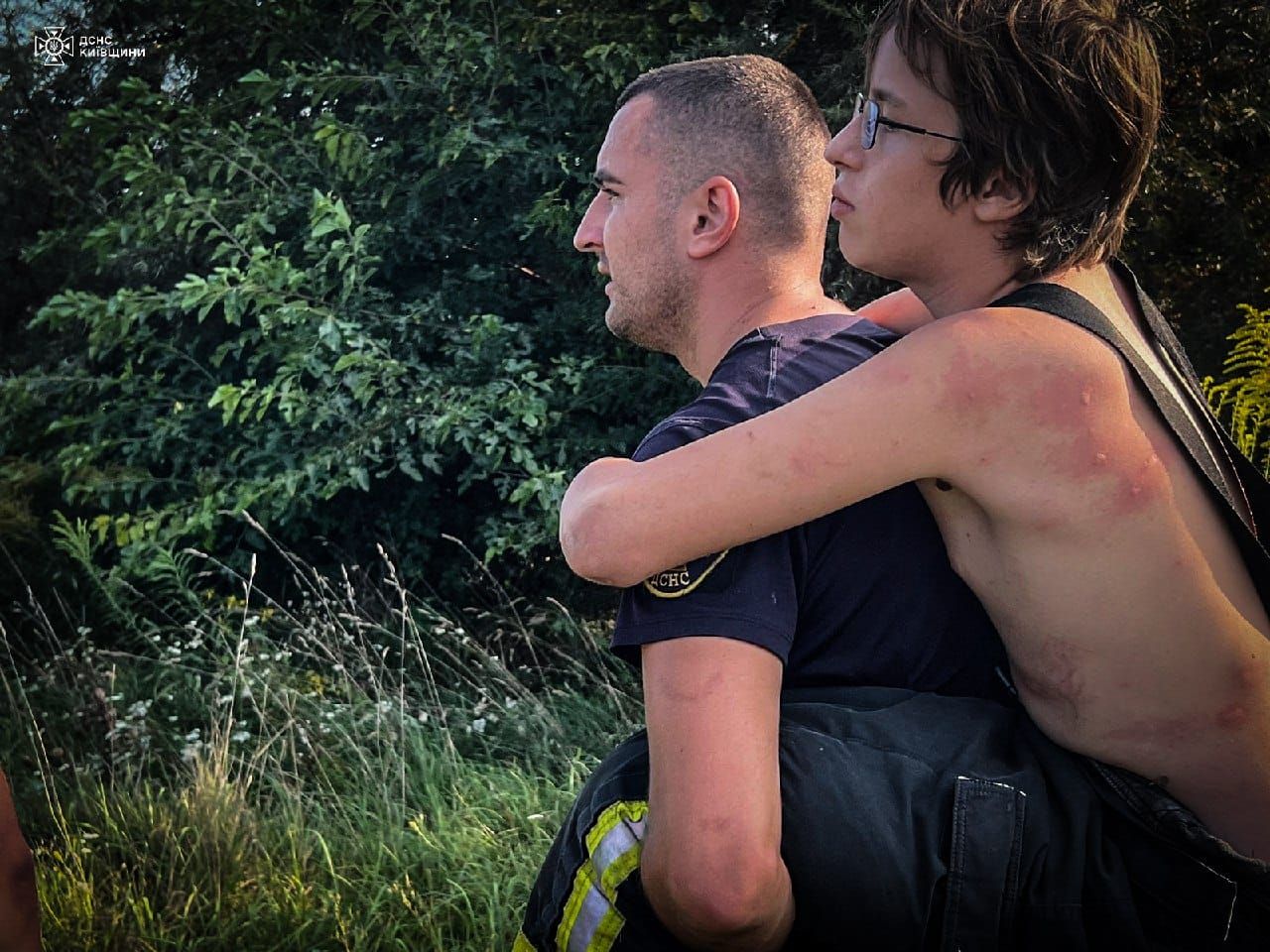 На Київщині хлопець застряг у болоті: покусаного до покрасніння п'явками його шукали рятувальники з дроном 1