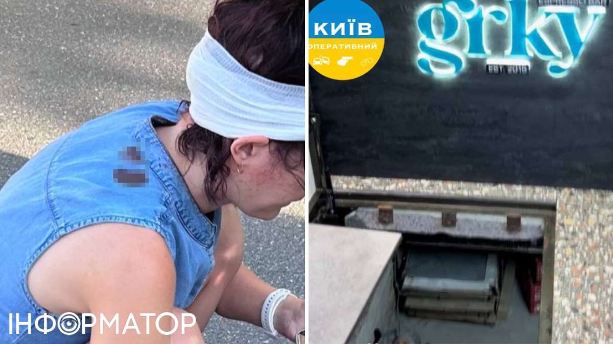 Посетительница получила повреждение от падения, ей наложили швы. Фото: Telegram-паблик Киев оперативный Посетительница получила повреждение от падения, ей наложили швы. Фото: Telegram-паблик Киев оперативный