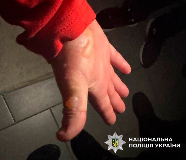 В Киеве поймали ревнивца: сжег автомобиль нового избранника 2