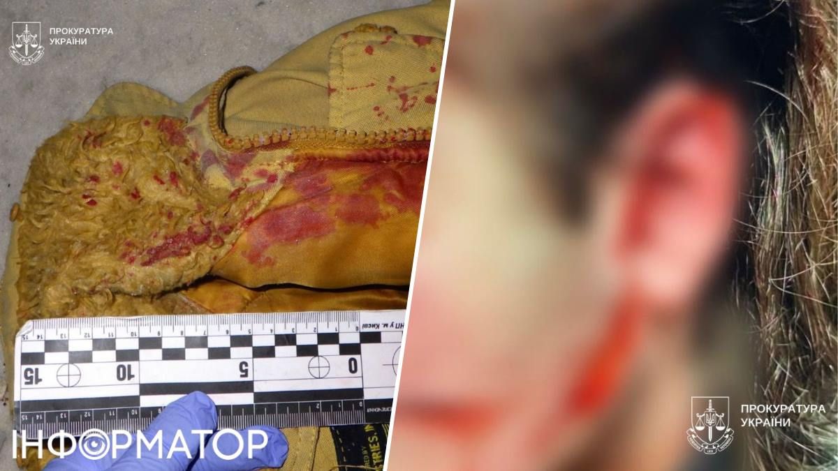 Чоловік порізав 17-річного хлопця канцелярським ножем. Фото: Київська міська прокуратура