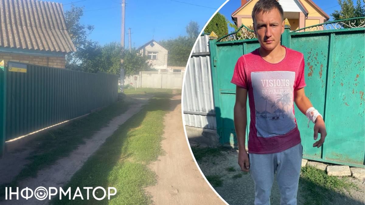 Думав, стечу кров'ю, так було страшно - під Києвом сусідка викликала ТЦК на молодика, а той порізав себе ножем