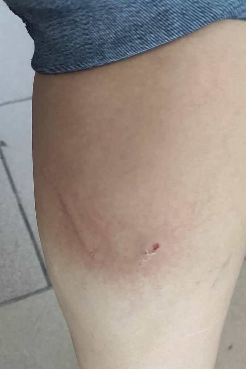 У Коломиї бродячі собаки покусали жінку 1