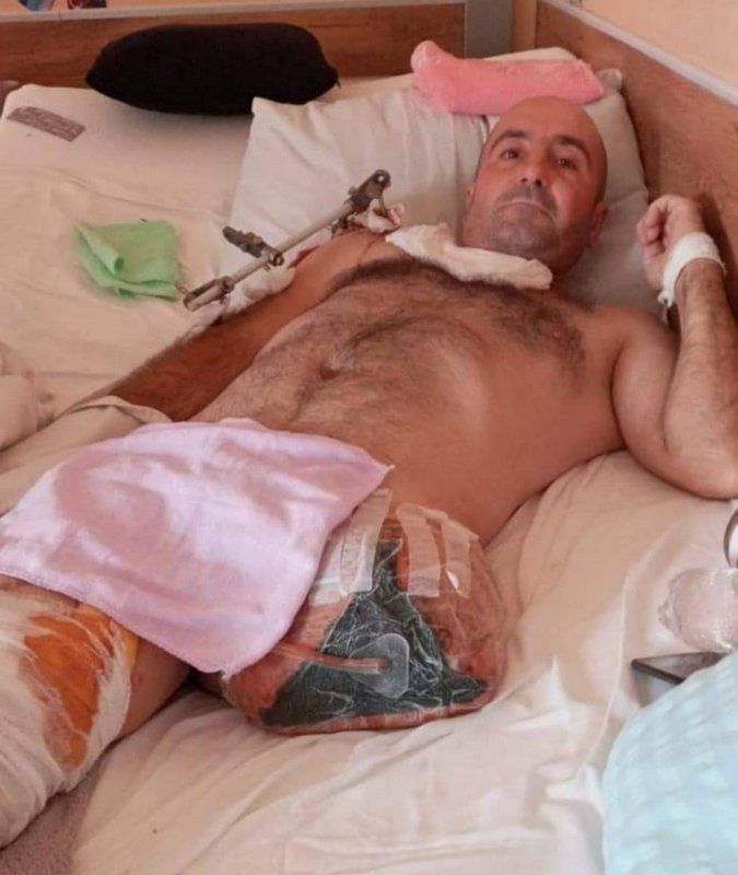 Військовий Орест Борис потребує допомоги - кожна гривня важлива 1