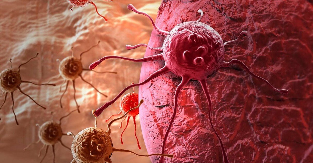 Рання діагностика раку: симптоми та обстеження 1