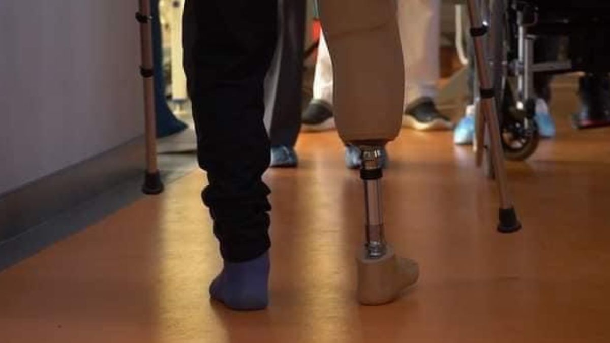 На Прикарпатті провели перше протезування військовому в клініці 2