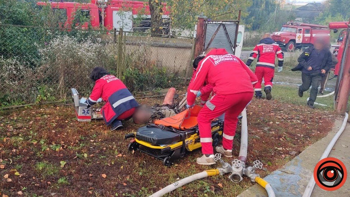 На Коломийщині у пожежі вранці 11 жовтня постраждала людина