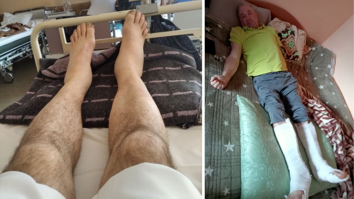 Василь Николайчук залишиться інвалідом