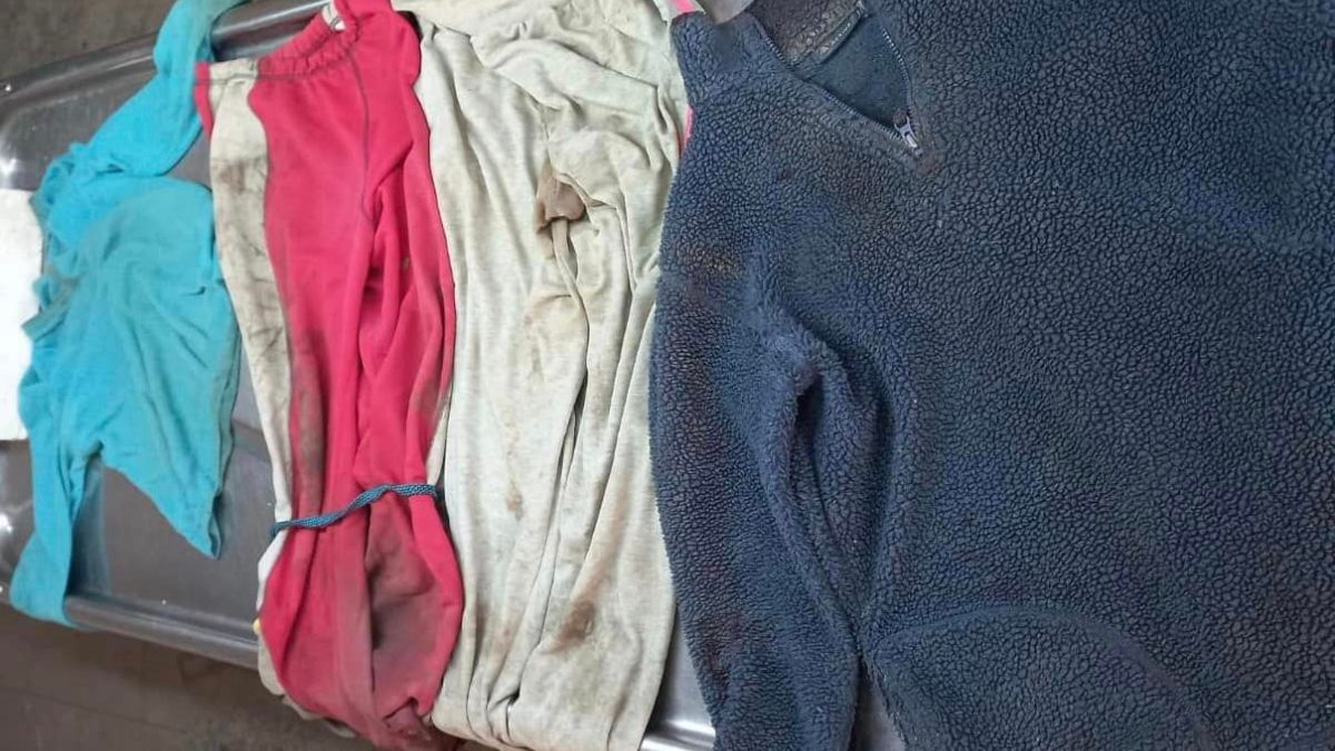 Чоловіка знайшли мертвим на об'їзній Коломиї: намагаються встановити особу 3