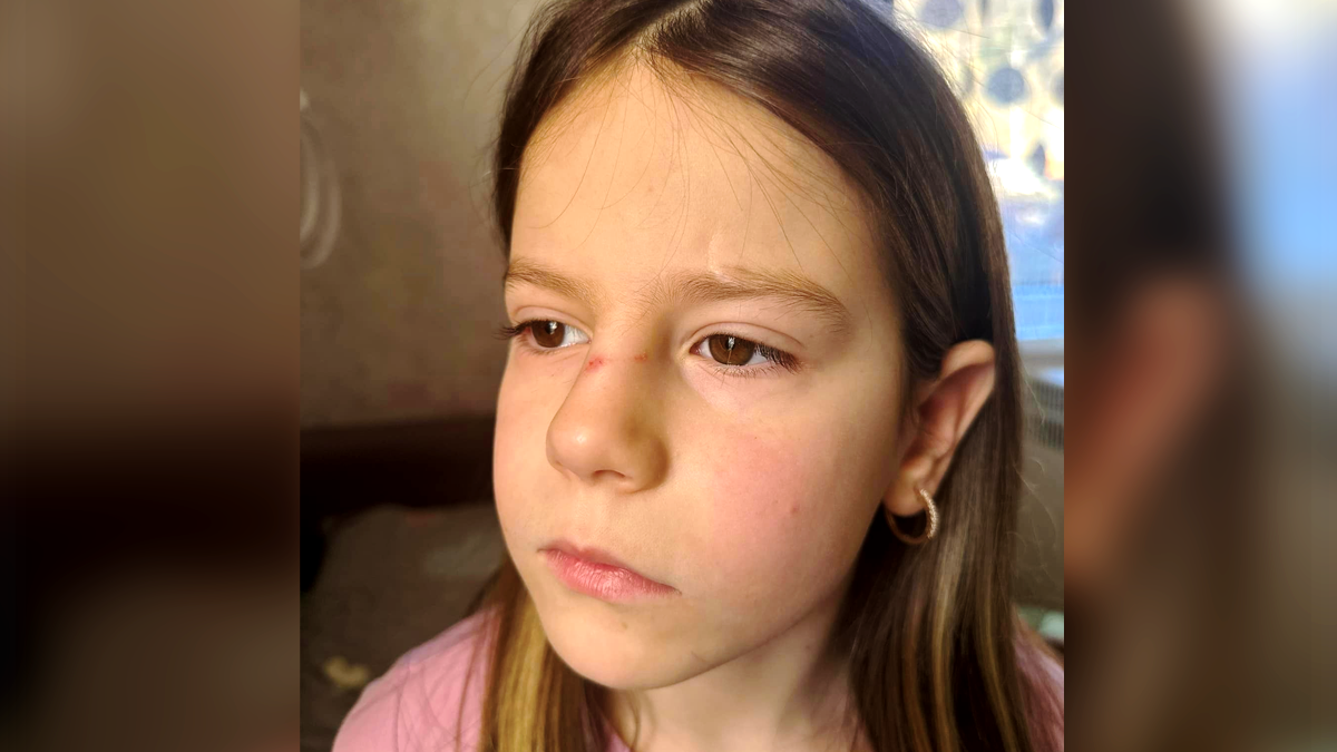 травми у дитини