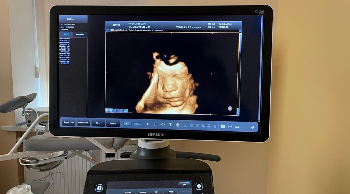 Жінкам на замітку: які послуги пропонує гінеколог та лікар УЗД Шараневич Володимир 1