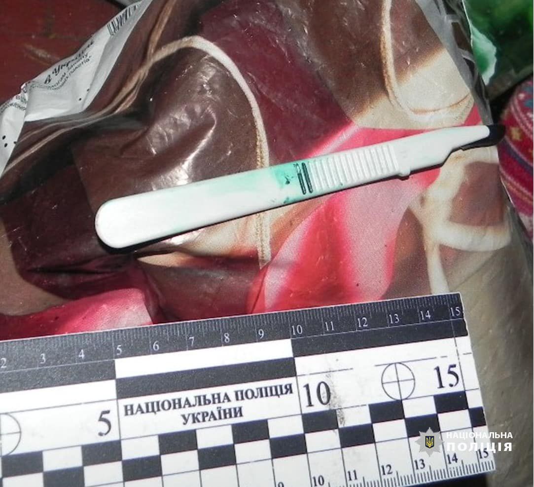 На Коломийщині п'яний чоловік штрикнув свою знайому скальпелем 1