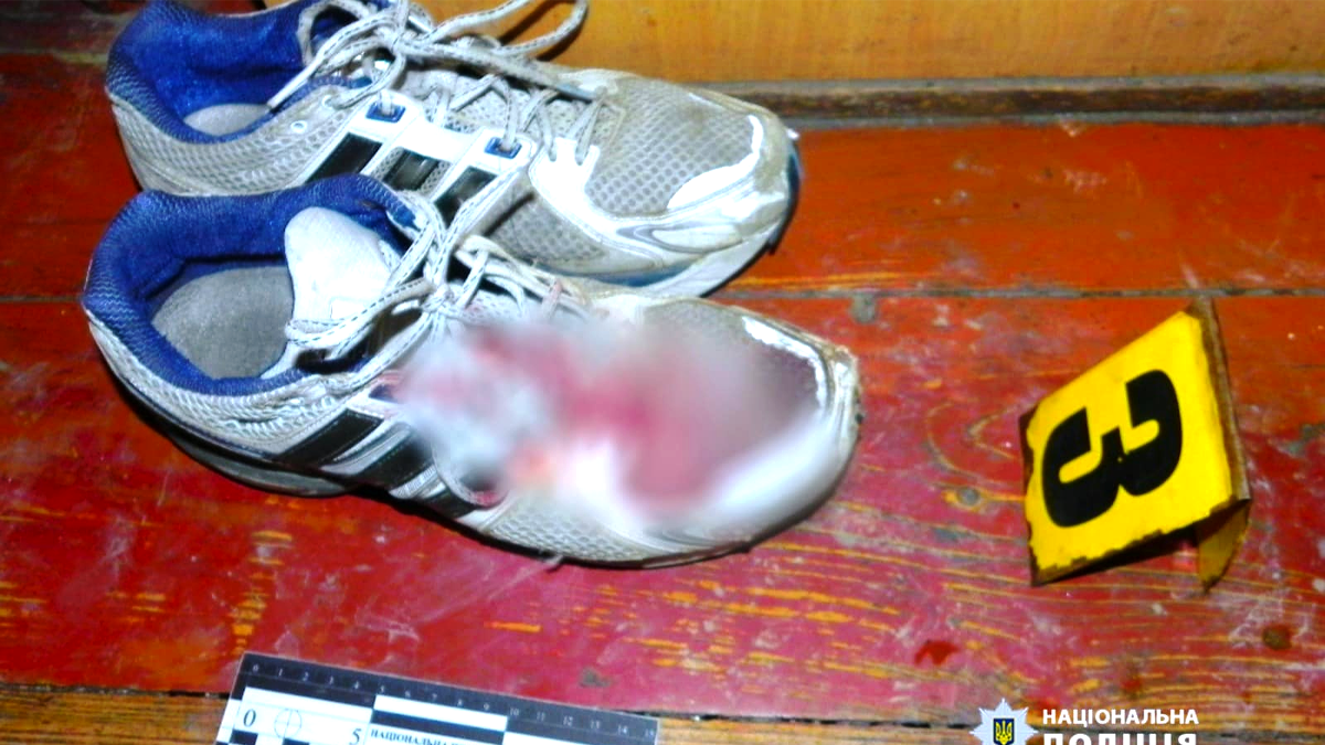 На Коломийщині чоловік під час застілля вдарив приятеля ножем 2