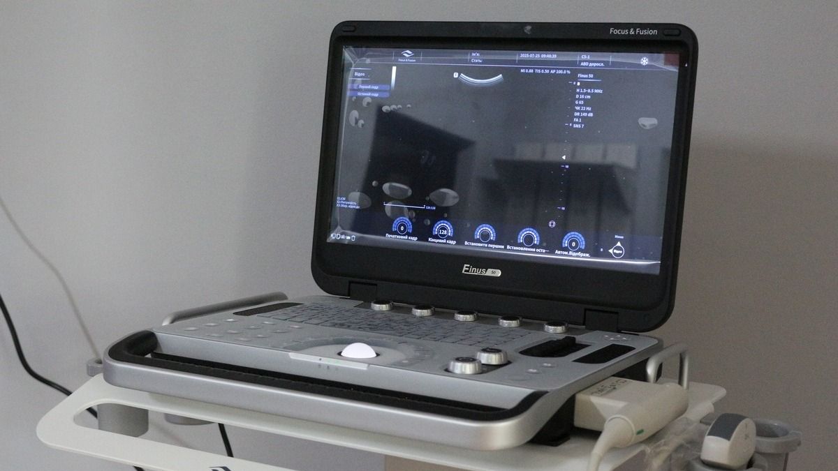 Лікарня у Коломиї отримала новий апарат УЗД