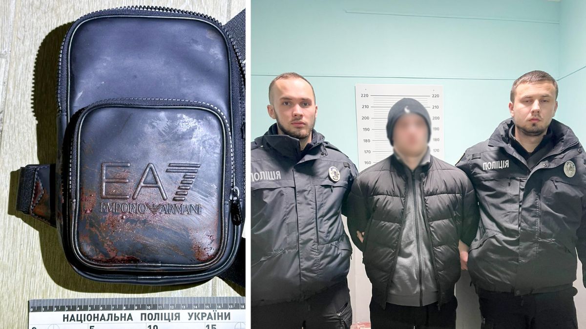 Пів року в бігах та затримання у Коломиї: поліція спіймала прикарпатця, який жорстоко побив рівнянина