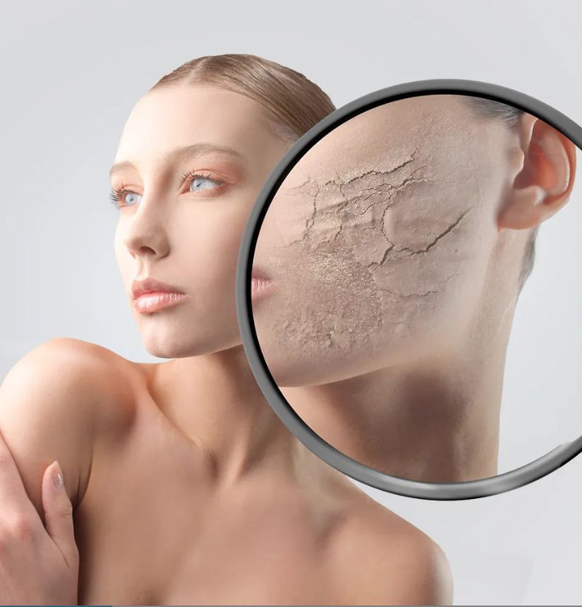 Зимові проблеми зі шкірою можуть призводити до неприємних відчуттів. Зимові проблеми зі шкірою можуть призводити до неприємних відчуттів.